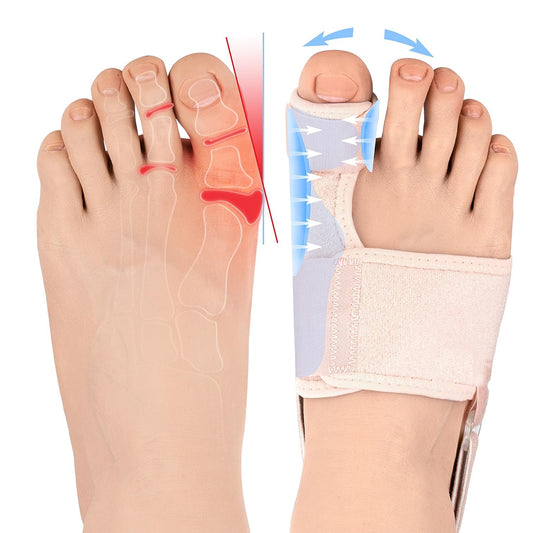 Healthadss ™ 2 PCS Bunion Corrector for Bunion Relief, Hallux Valgus Corrector for Bunion Splint, Day/Night Support