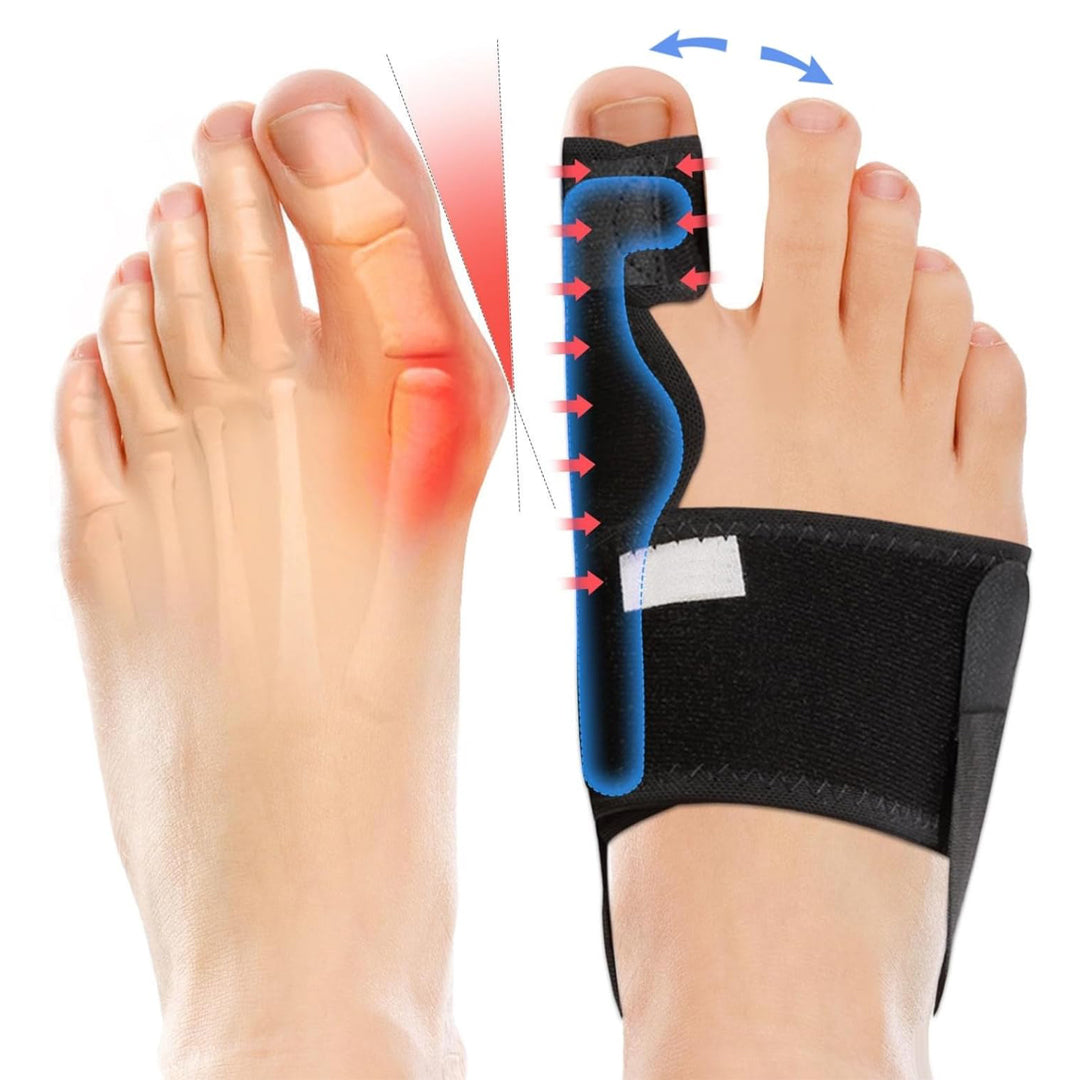 Healthadss ™ Adjustable Bunion Splint Brace Big Toe Straightener for Bunion Pain Relief, Hallux Valgus Correction Day/Night Support