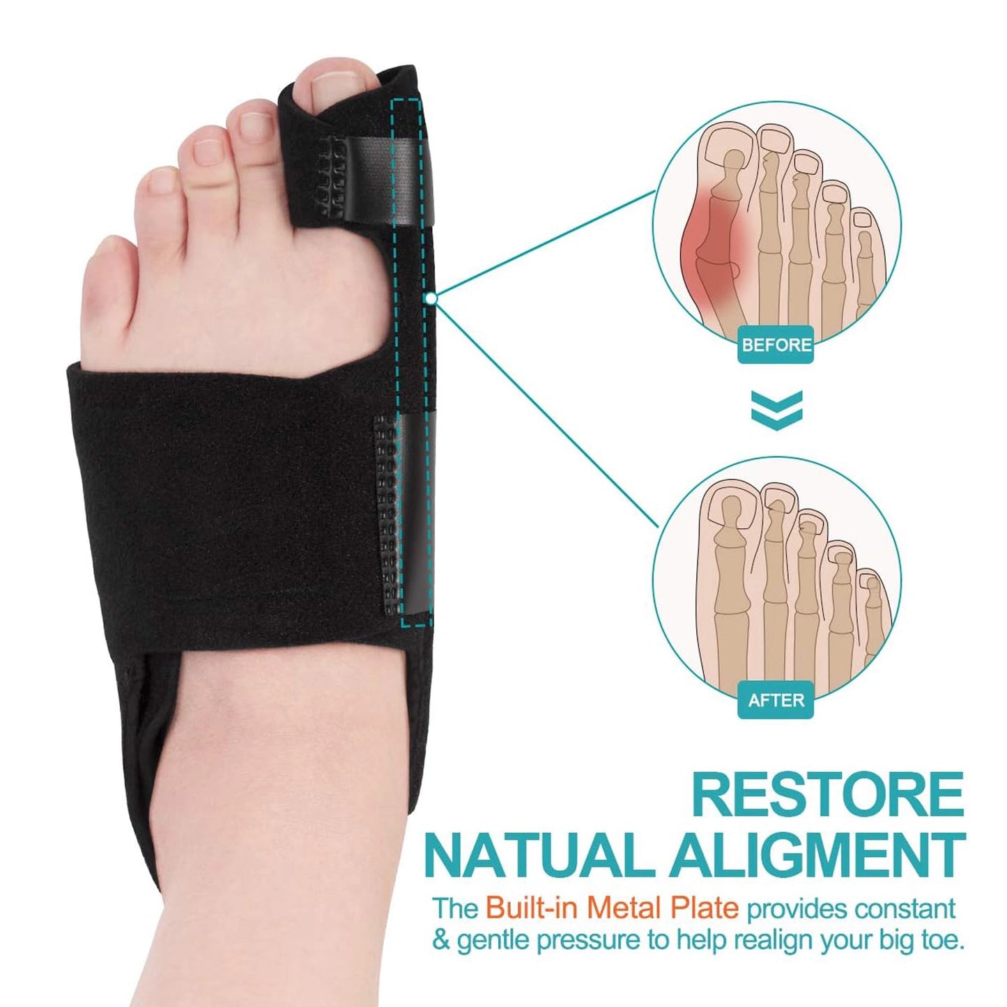 Healthadss ™ Bunion Corrector with 2 Pack Gel Toe Separators