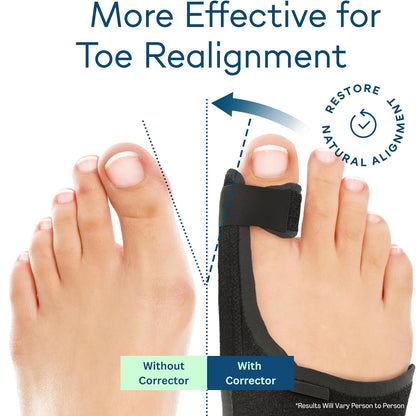 Healthadss ™ Night Bunion Splint,Big Toe Straightener, Bunion Brace for Bunion Pain Relief