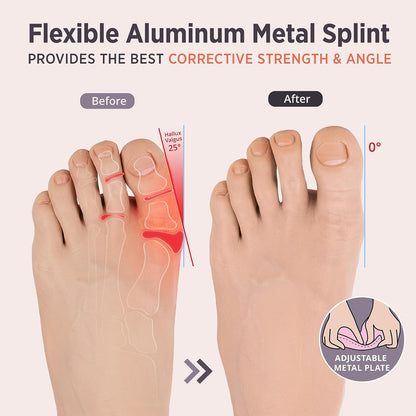 Healthadss ™ 2 PCS Bunion Corrector for Bunion Relief, Hallux Valgus Corrector for Bunion Splint, Day/Night Support